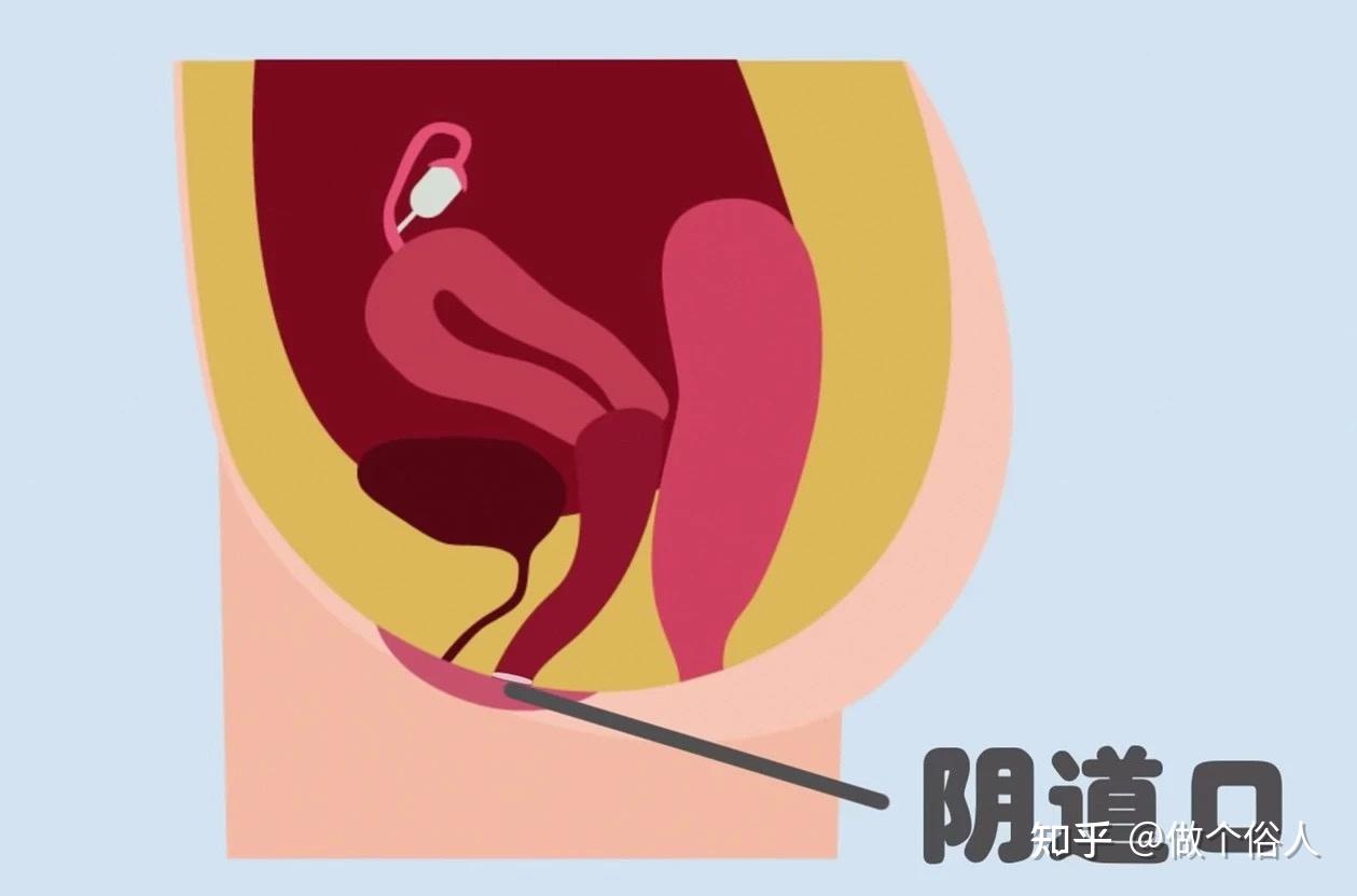 处女膜 