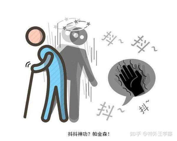 帕金森患者怎么判断自己适不适合脑起搏器?哪些患者不能装? - 知乎