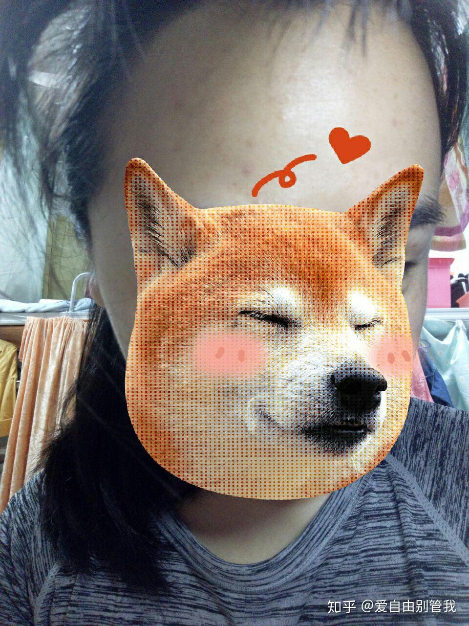 怎么治疗扁平疣?