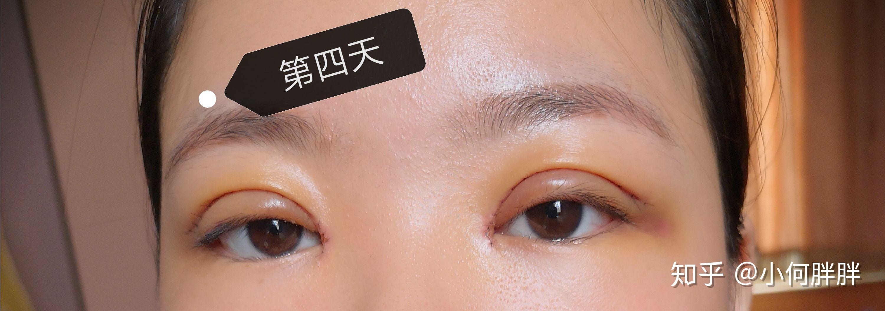 关于望京医院全程代诊含挂号术后伤口换药、复查全程陪同的信息