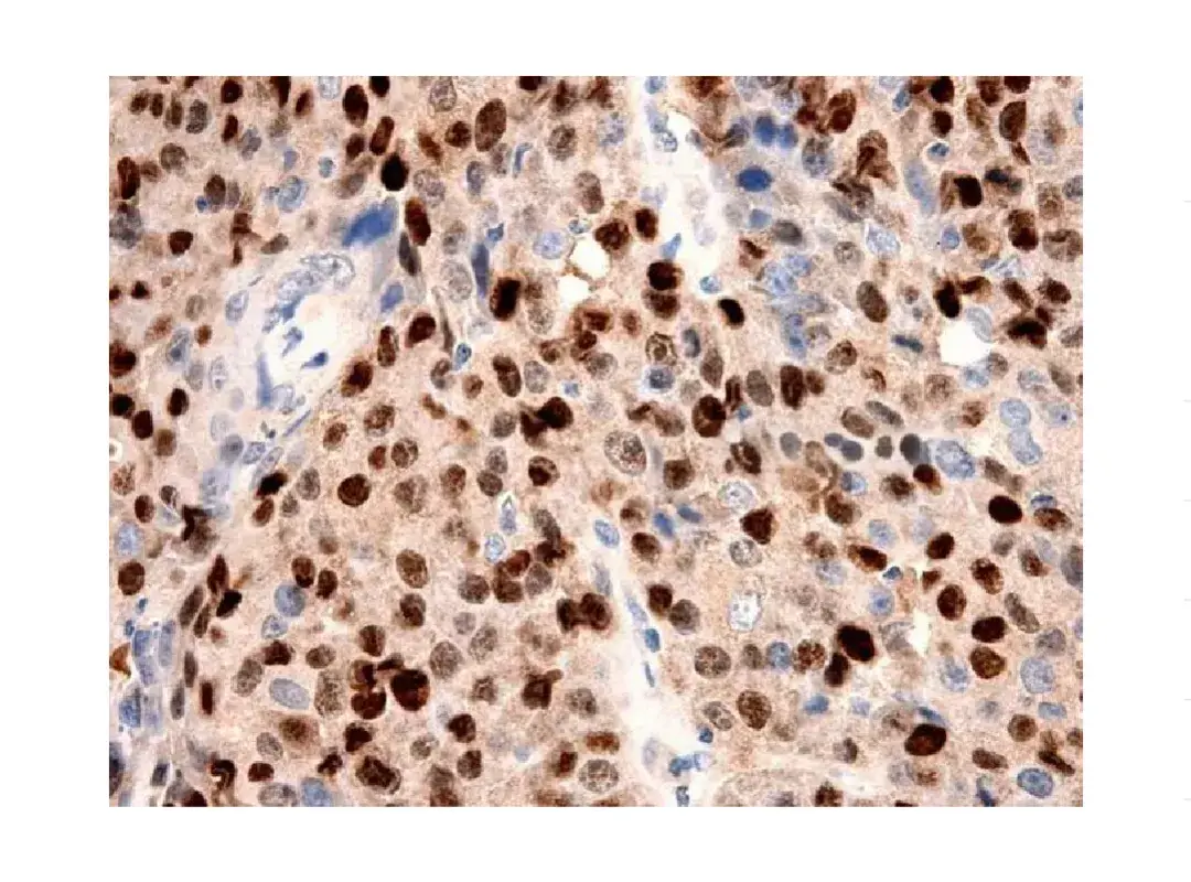 免疫组化 (IHC) 操作步骤 + 注意事项！| MedChemExpress (MCE) - 知乎