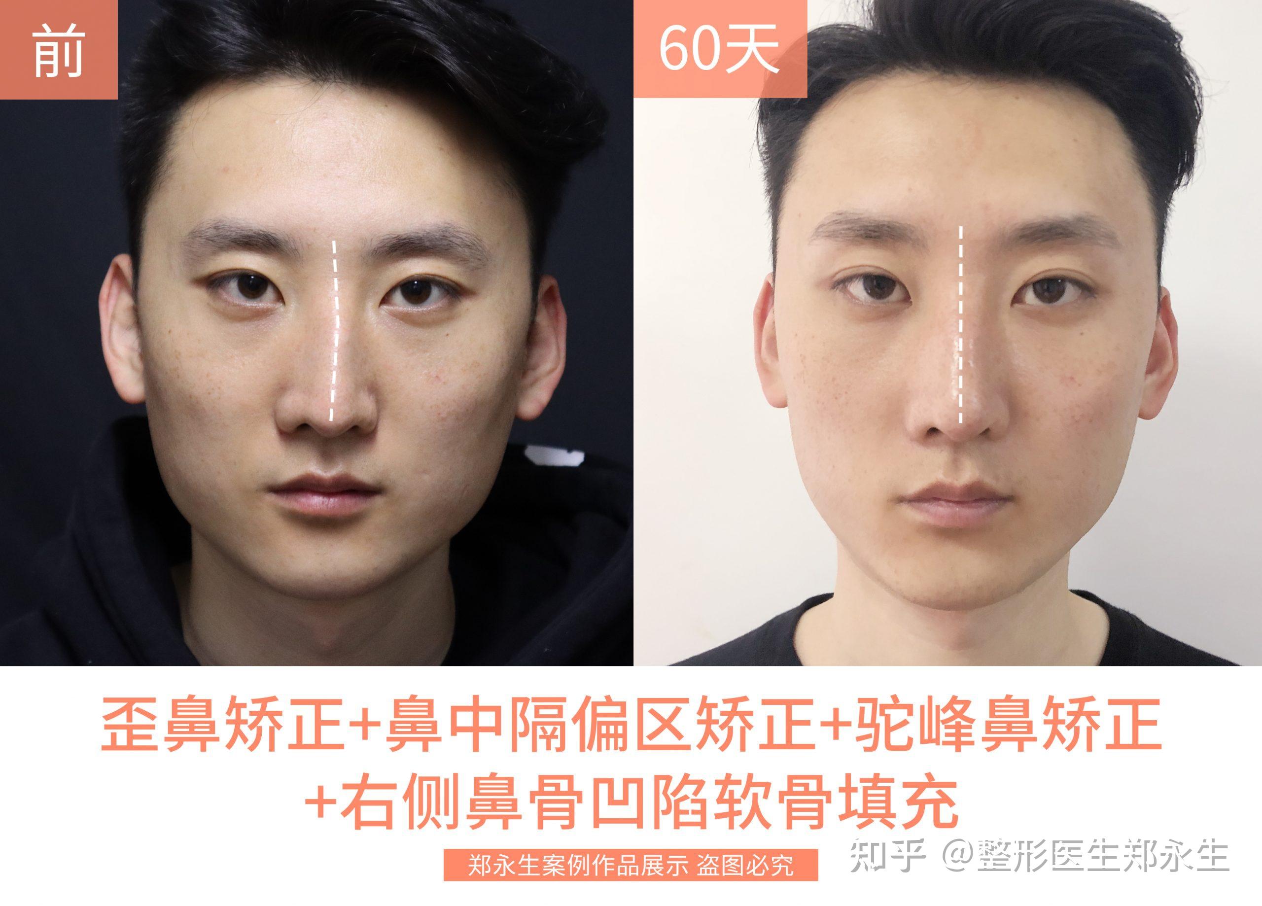 郑永生主任个人介绍及部分案例展示