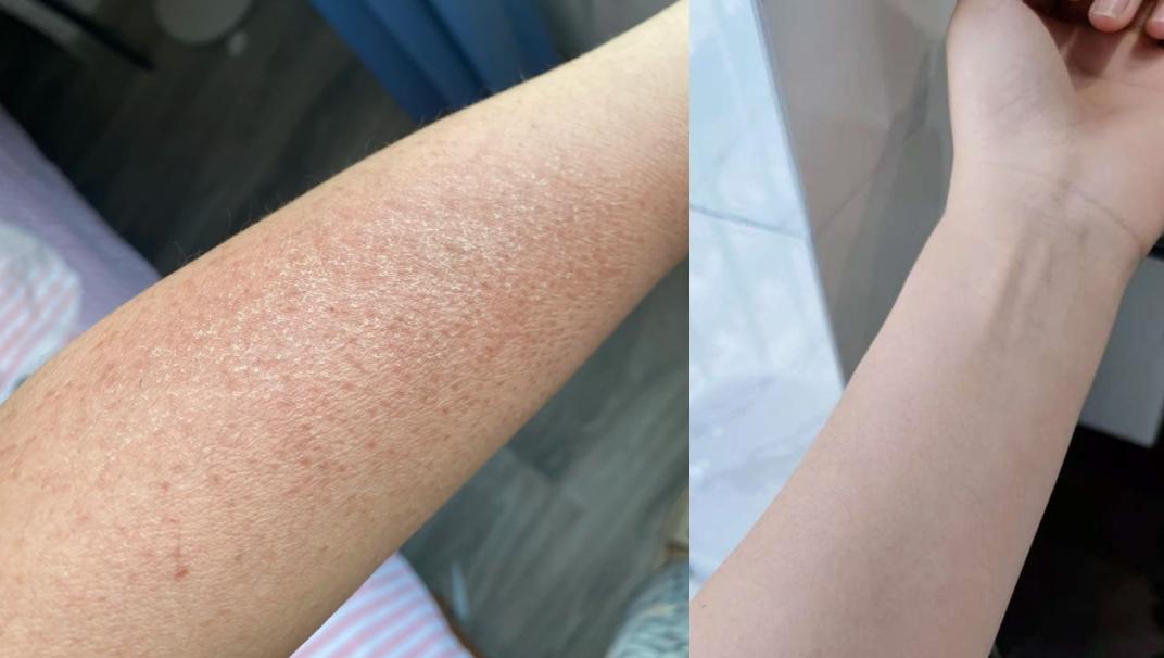 去黄美白,保湿舒敏,滋养嫩肤,让你皮肤白嫩香软又弹滑~~ - 知乎