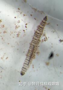 如何杀水中蚊子的幼虫 v2-a073c9bf49f1c6d6fb5ec694fda932b5_b.jpg
