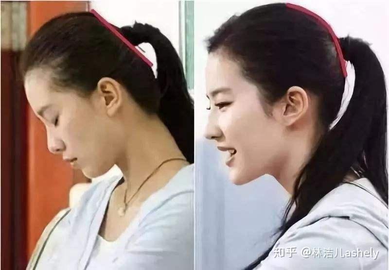 人好看连扁头也美?刘诗诗与刘亦菲的差距,就在这个颜值bug上 - 知乎
