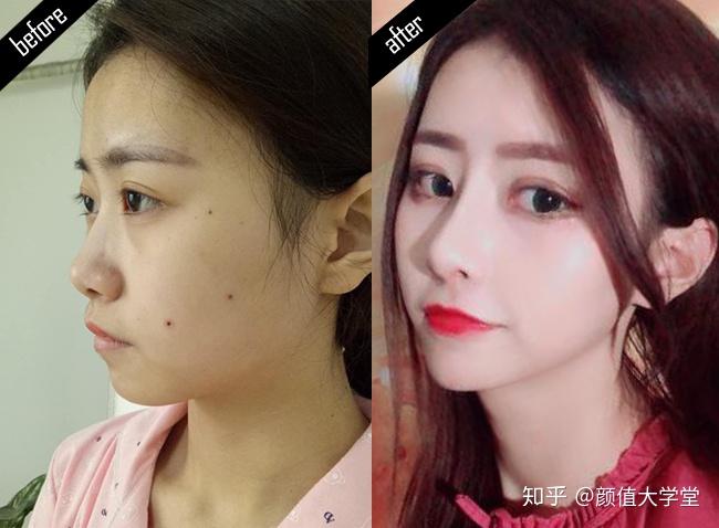 女装大佬艾比abbily撞脸潘南奎科普网红流水线整容的致命弊端