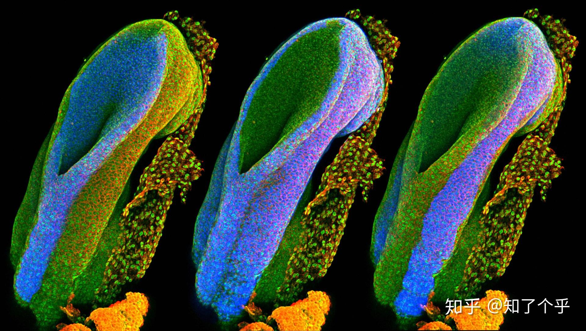 生物医学图像获奖作品分享:wellcome image awards