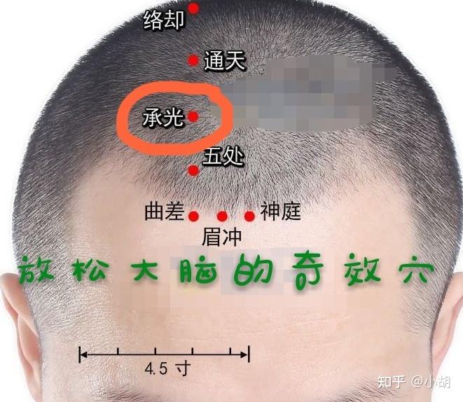 倪海厦针灸课笔记(14)足太阳膀胱经01 - 知乎
