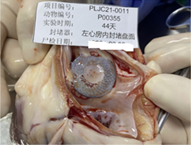 受房间隔分流器专利启发,打通 "天然阻隔"