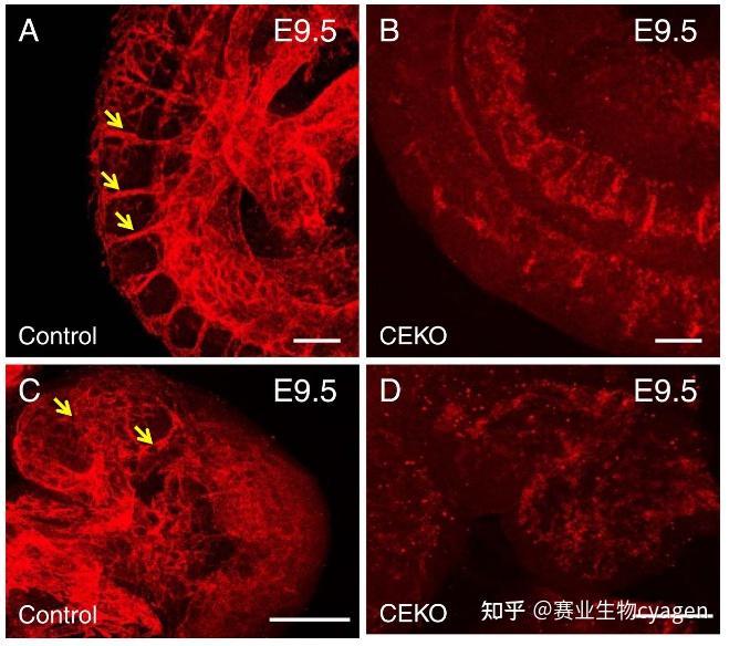pecam-1免疫荧光染色实验显示,与对照胚胎相比,ceko胚胎中无法形成