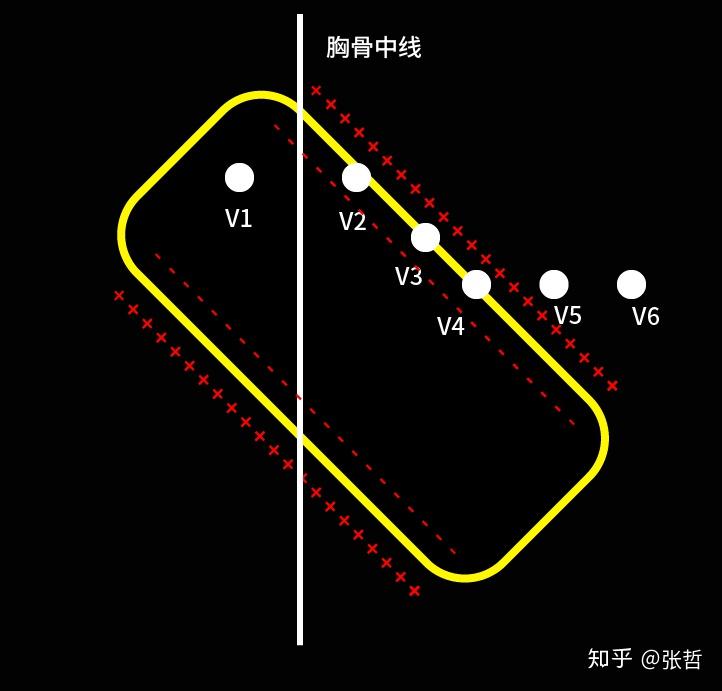 心電基礎二心電向量