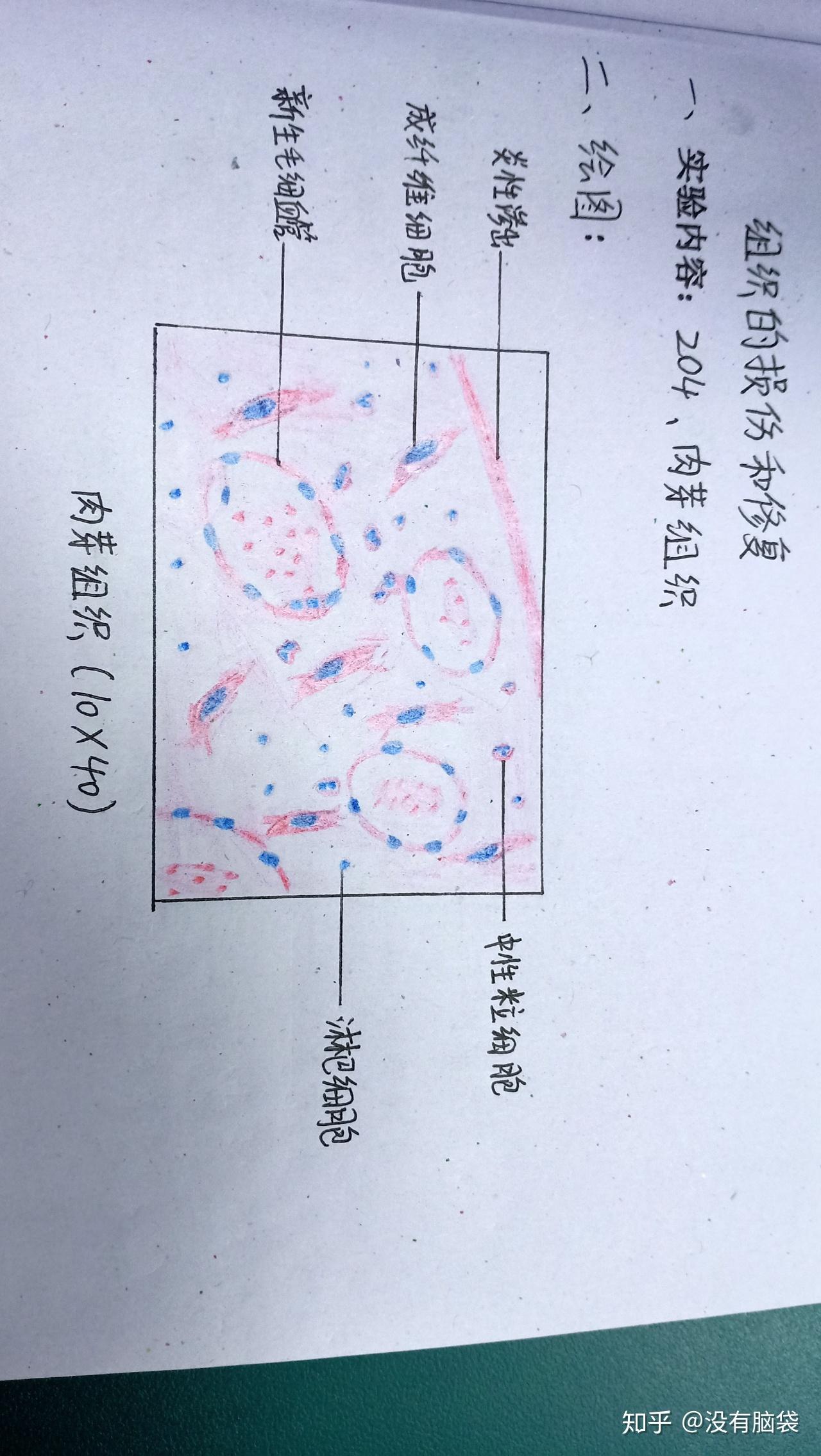 荚膜手绘图红蓝图片