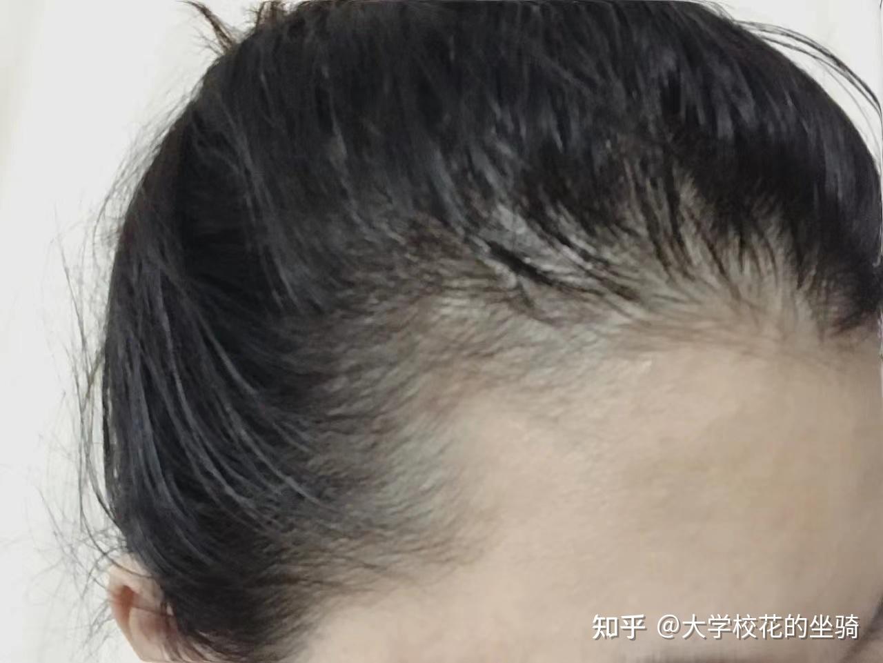 女生整理头发、挠头_3840X2160_高清视频素材下载(编号:7929654)_实拍视频_光厂(VJ师网) www.vjshi.com