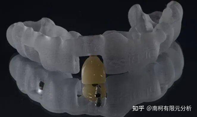 盘点:3D打印在牙科领域的八大应用 - 知乎