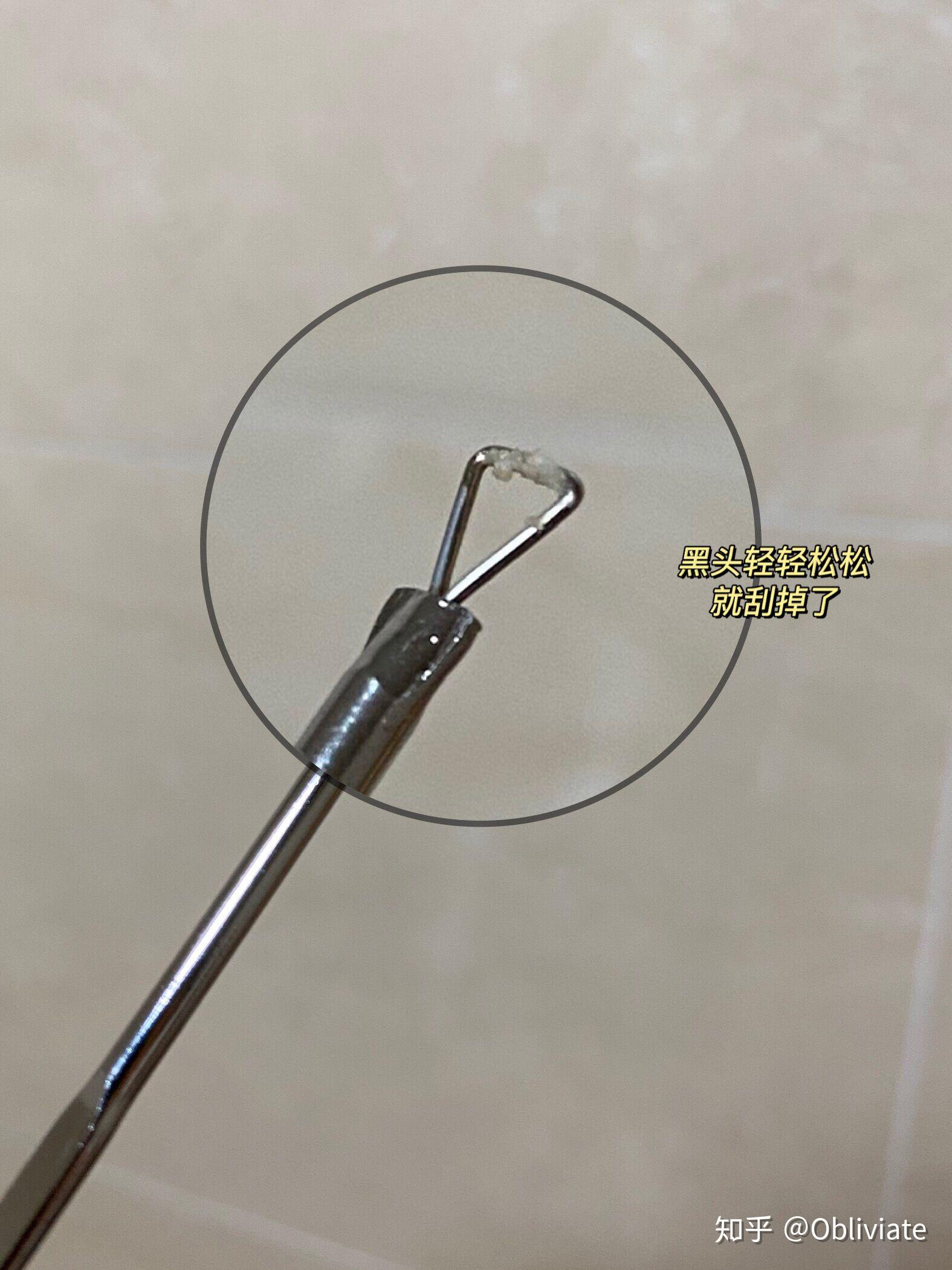 怎么科学的去黑头 v2-a1ecb424b32cc4d838dcceadfed1a511_r.jpg