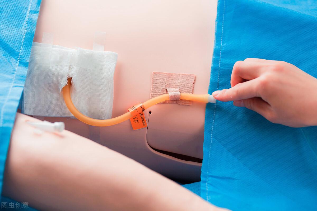 下面我们根据此病例总结一下各引流管的护理