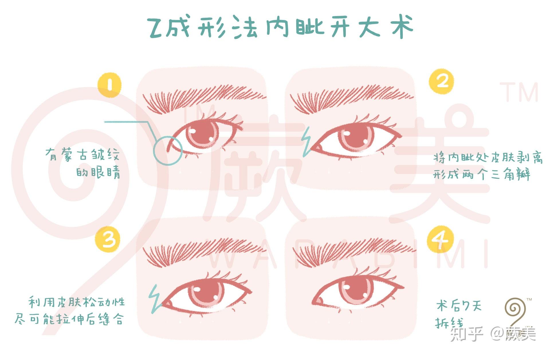 开眼角让眼睛变大的魔术