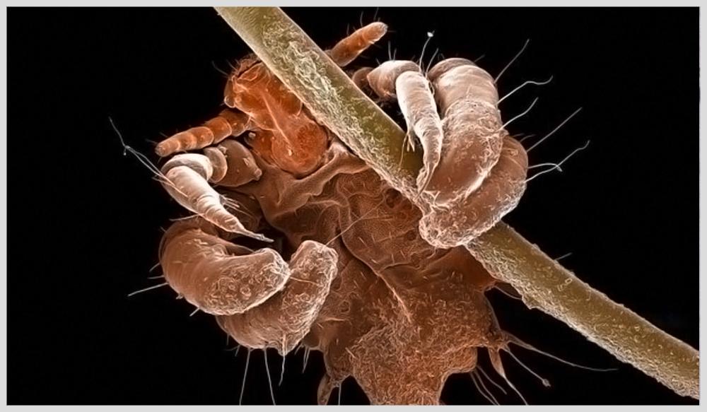 孙叔公科普令人毛骨悚然的身体变异竟是寄生虫在作怪