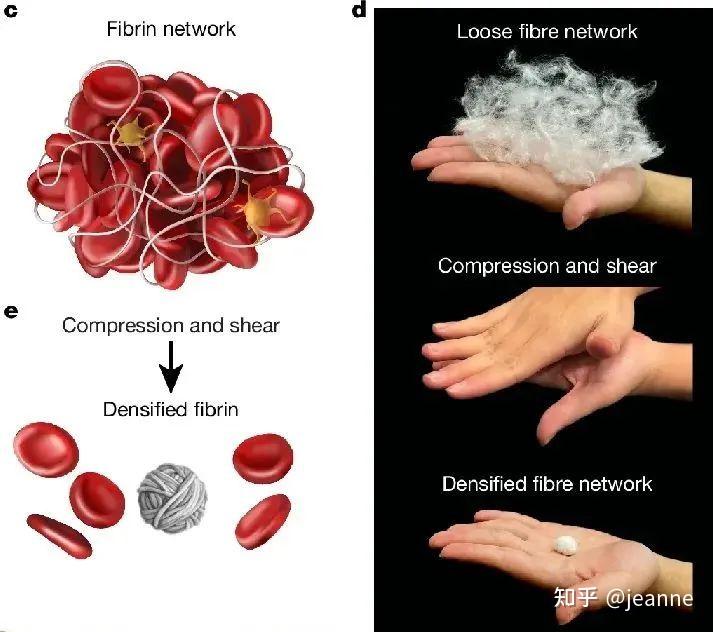 Nature: 一种快速疏通血管、取走血栓的方法 - 知乎