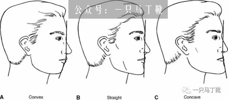 凸嘴怎么画 v2-a291c2cfd386fb1cc443ff1a0f6294ed_r.jpg