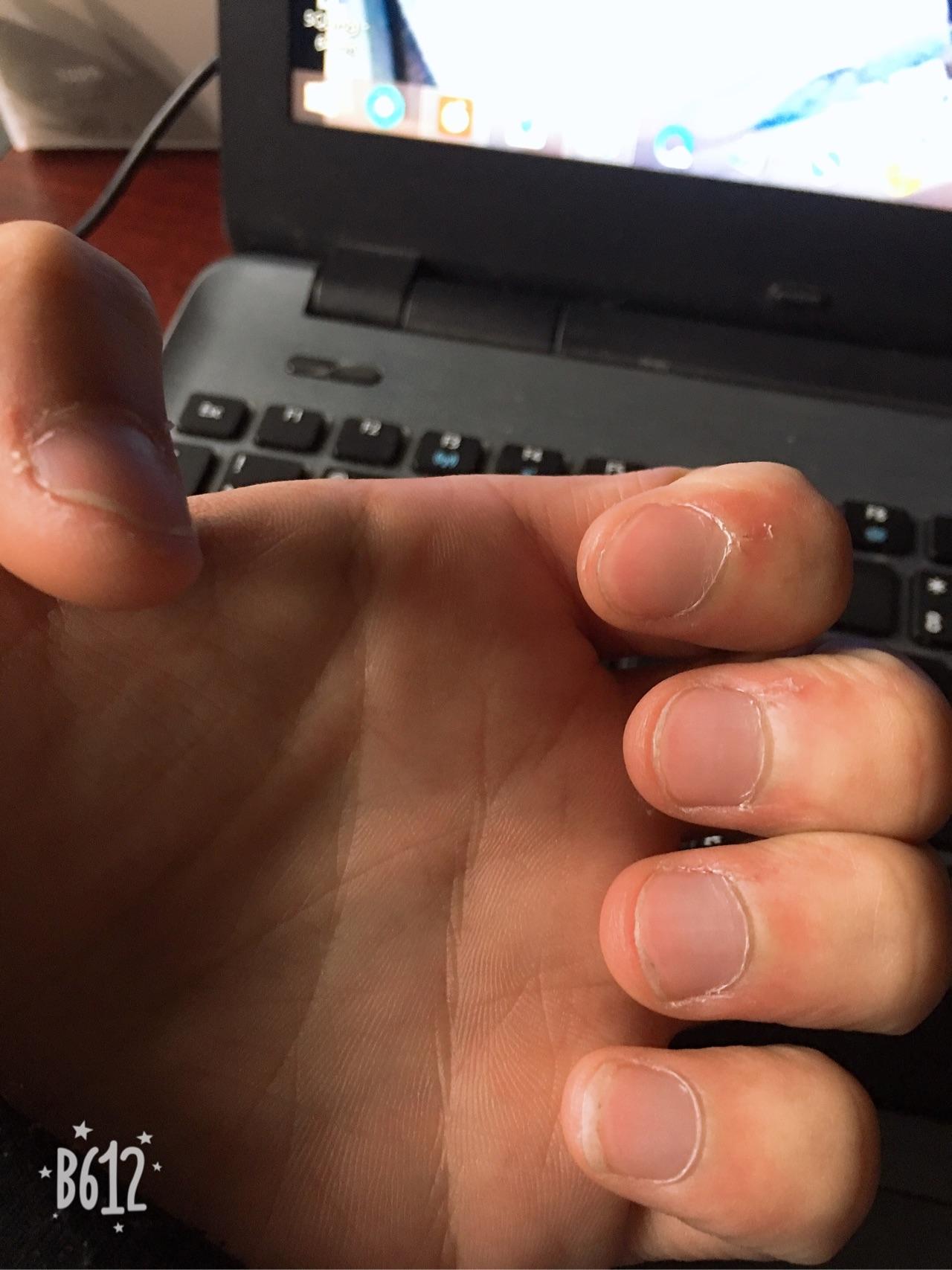 怎么样才能戒掉咬指甲的习惯 v2-a2cc51fc64e5f19e4f8d58d932315217_r.jpg