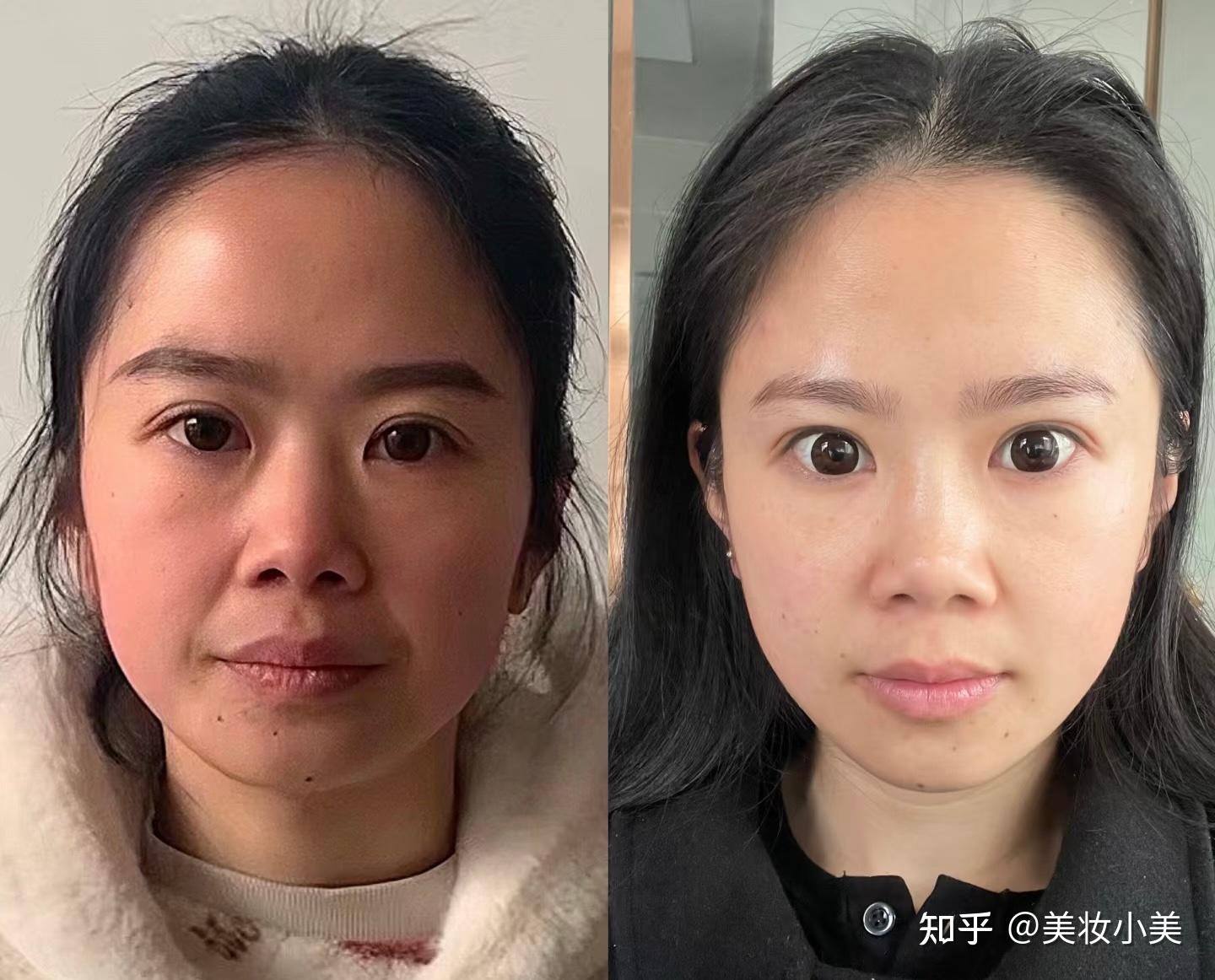 女人不养脾 迟早脸要垮 纯干货 - 知乎