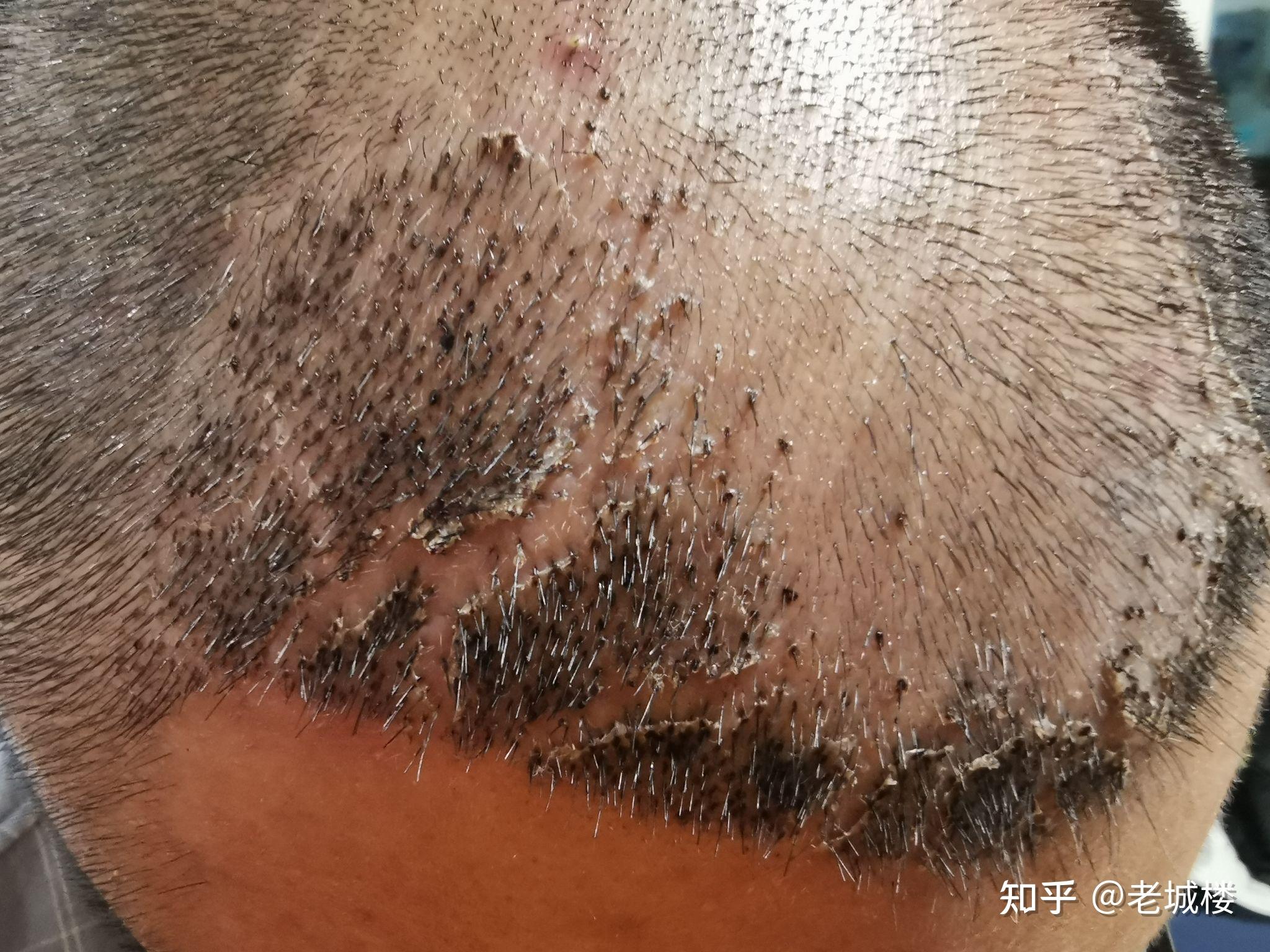 day2—坚持就是胜利