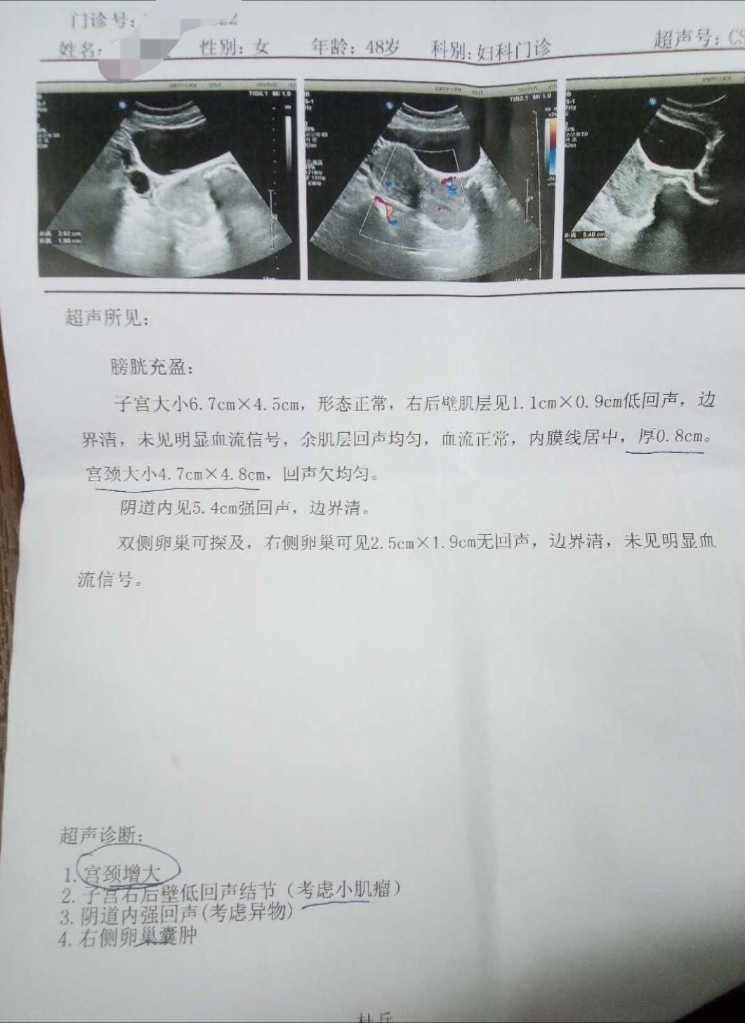 宫颈癌分期是依据什么判定的