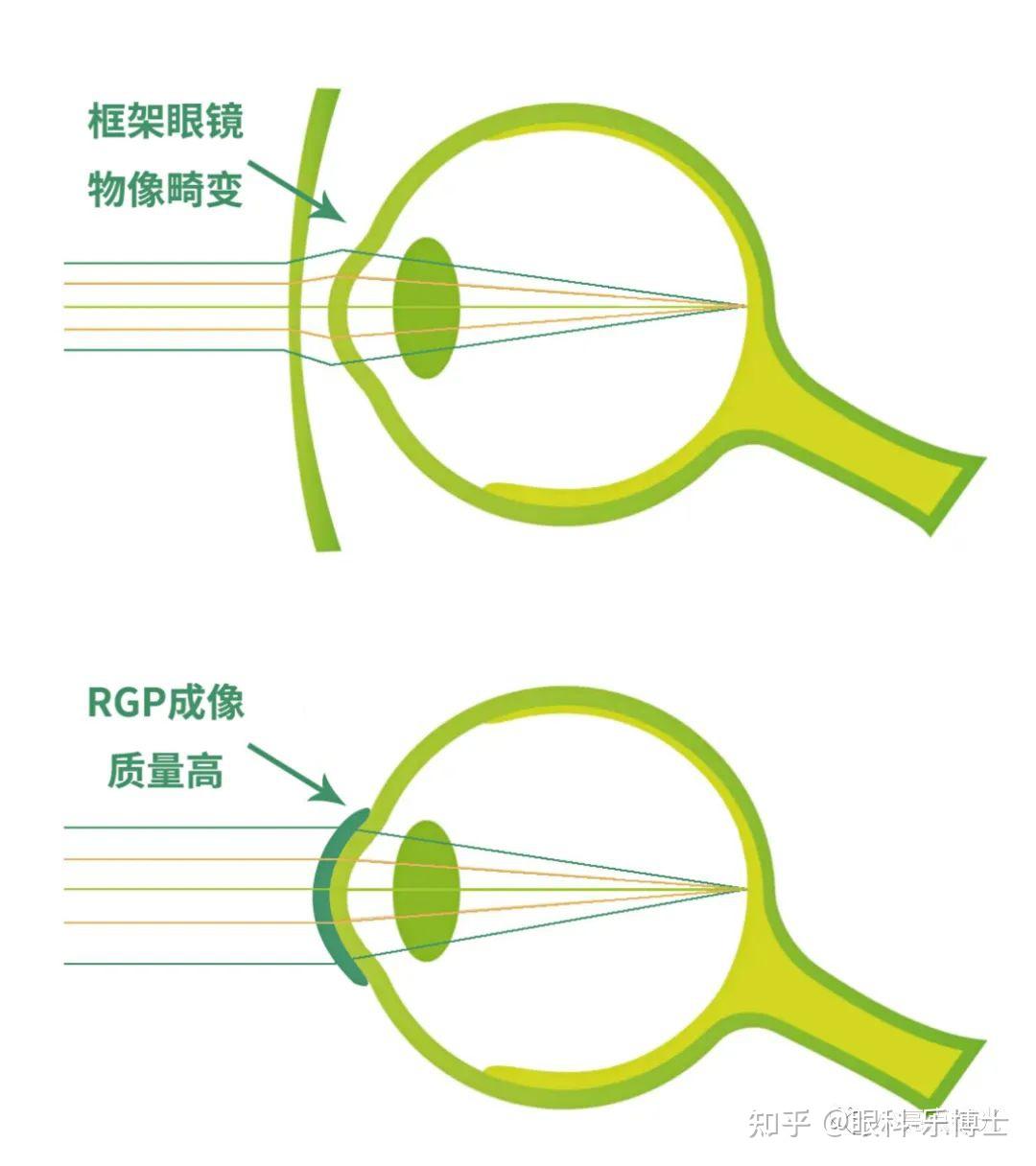 角膜高倍镜图片