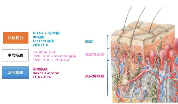 痤瘡田豔麗博士超分子水楊酸治痘痘靠譜嗎