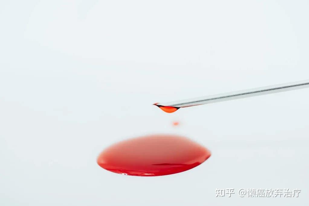 「无偿」献的血,最后都用在哪里了? - 知乎
