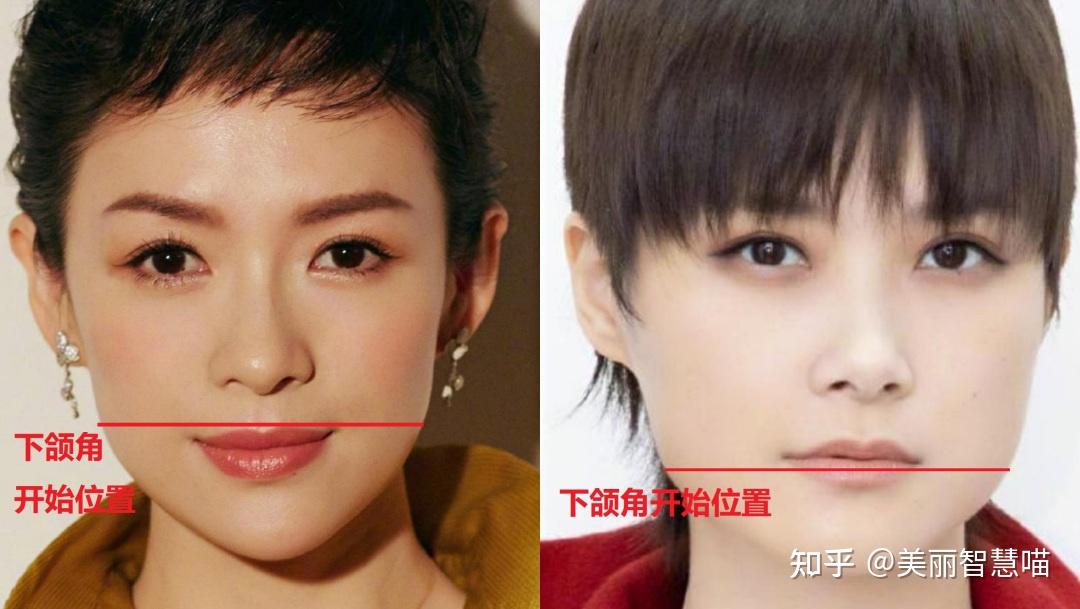 而且下颌角的位置也决定了一个人的面部宽窄程度.