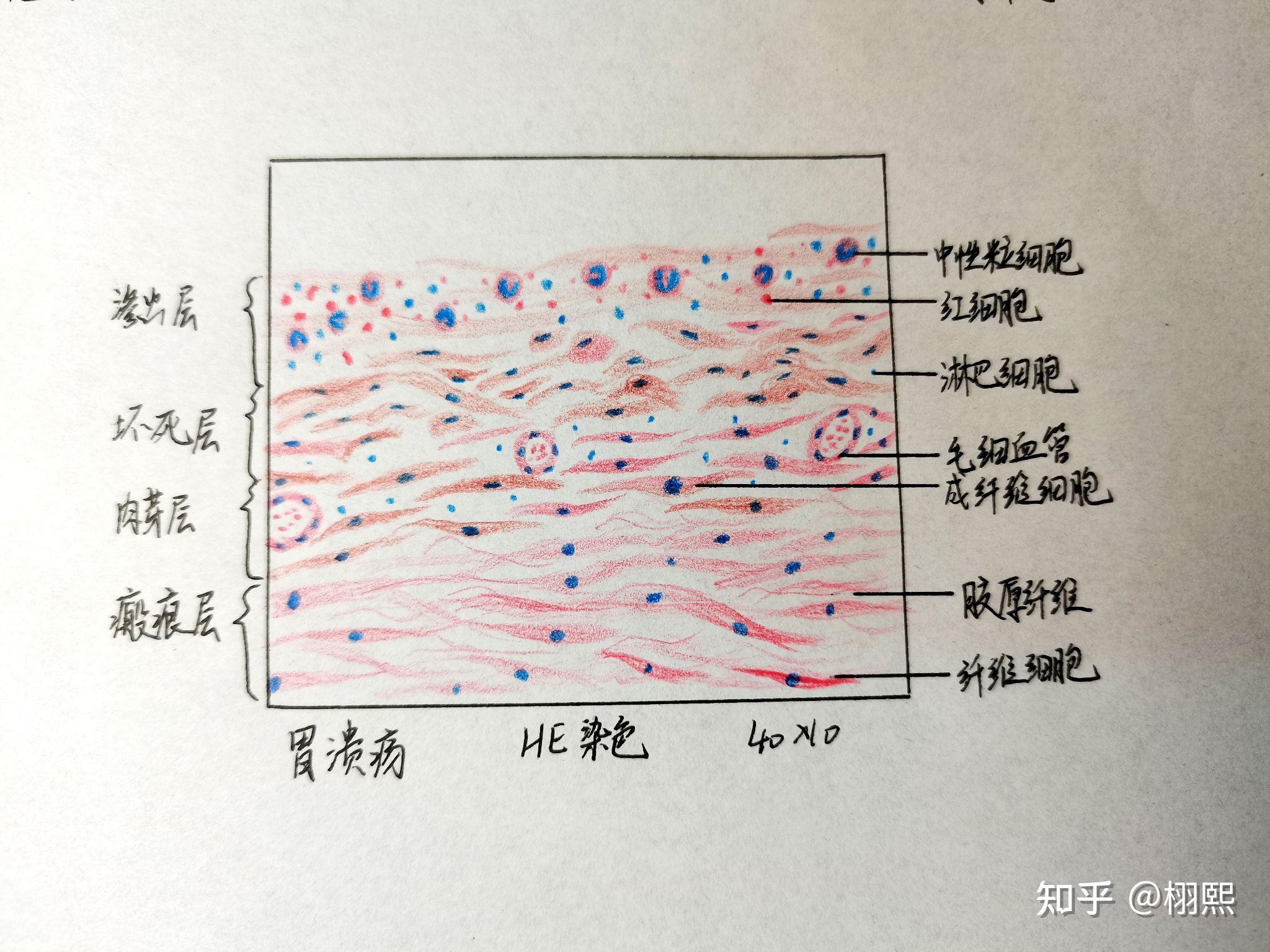 病理实验报告红蓝铅笔手绘图