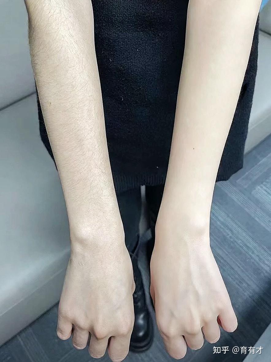 这一胳膊的毛毛终于脱干净了