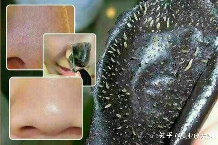 怎么把鼻子上的小黑毛去干净