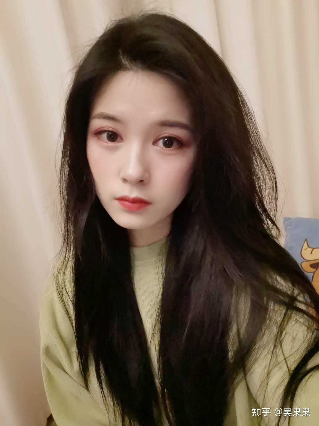 亲身经历分享友谊医院颧骨下颌角太有必要做了