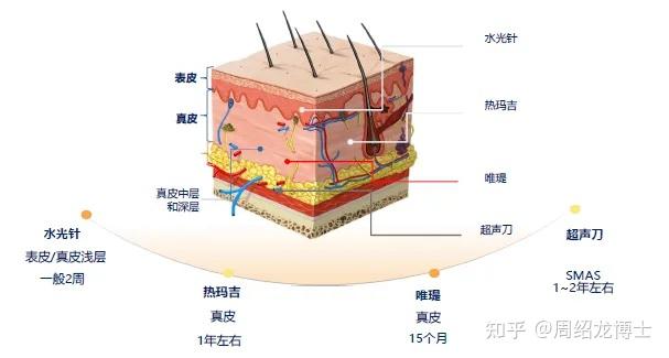 ②肉毒素注射能夠阻滯運動神經末梢乙酰膽鹼的釋放,抑制動態表情,減少