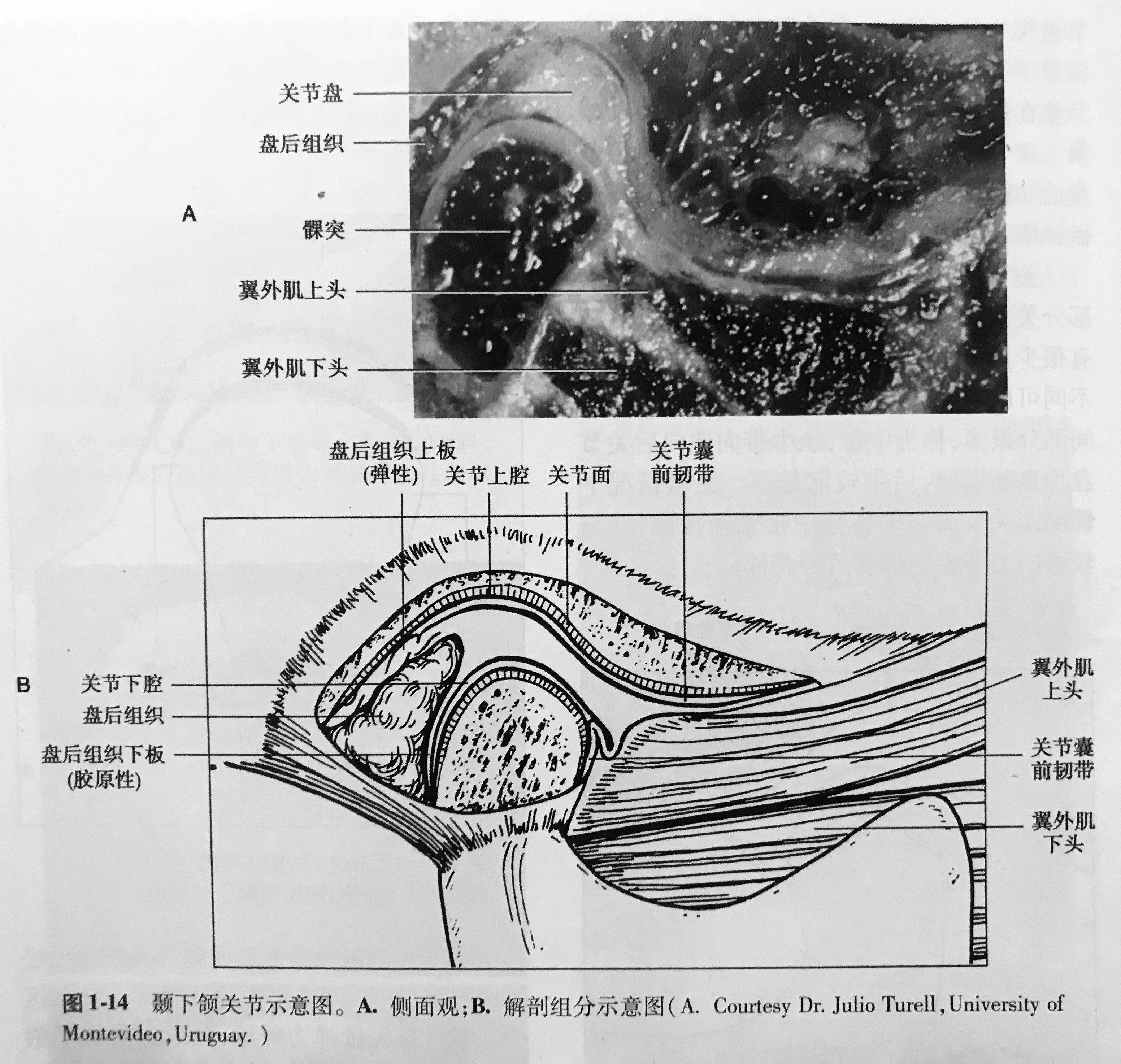 颞下颌关节解剖图手绘图片