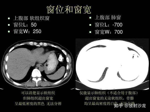 超细的腹部CT入门精美解剖图谱 - 知乎