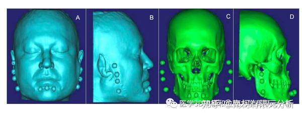 颞下颌关节有限元模型的生物力学特征 - 知乎
