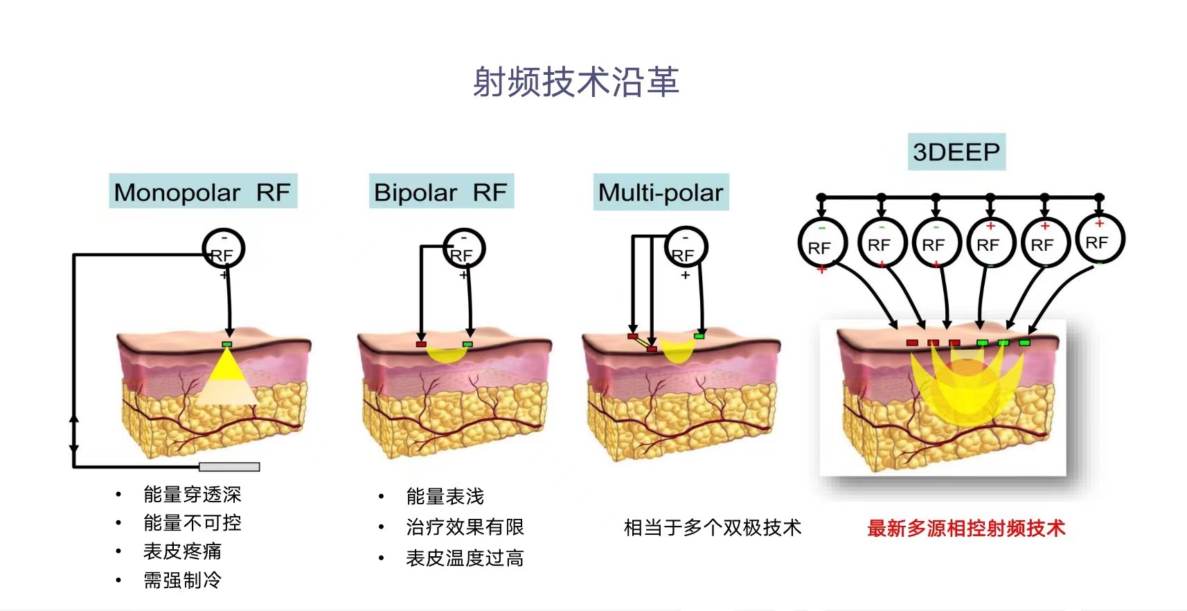 痤疮科普100问q51q71痘痘的治疗方法篇