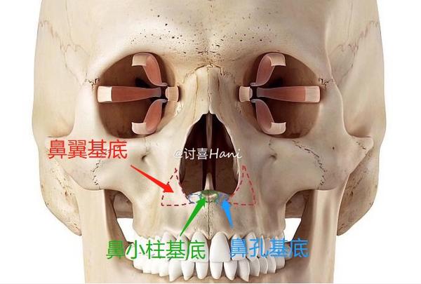讨喜Hani | 最全鼻基底填充干货,看这篇就够了 - 知乎