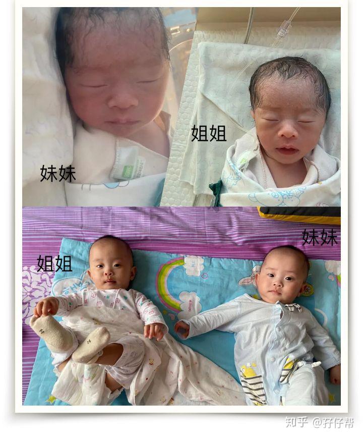 几个月能看出来是否双胞胎 v2-a4e1f85e2df6e9a3f416406803a2c541_r.jpg