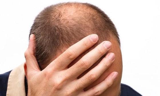 v2-a541558d4ac278993fcd87f87a028ac2_1440w.jpg?source=172ae18b