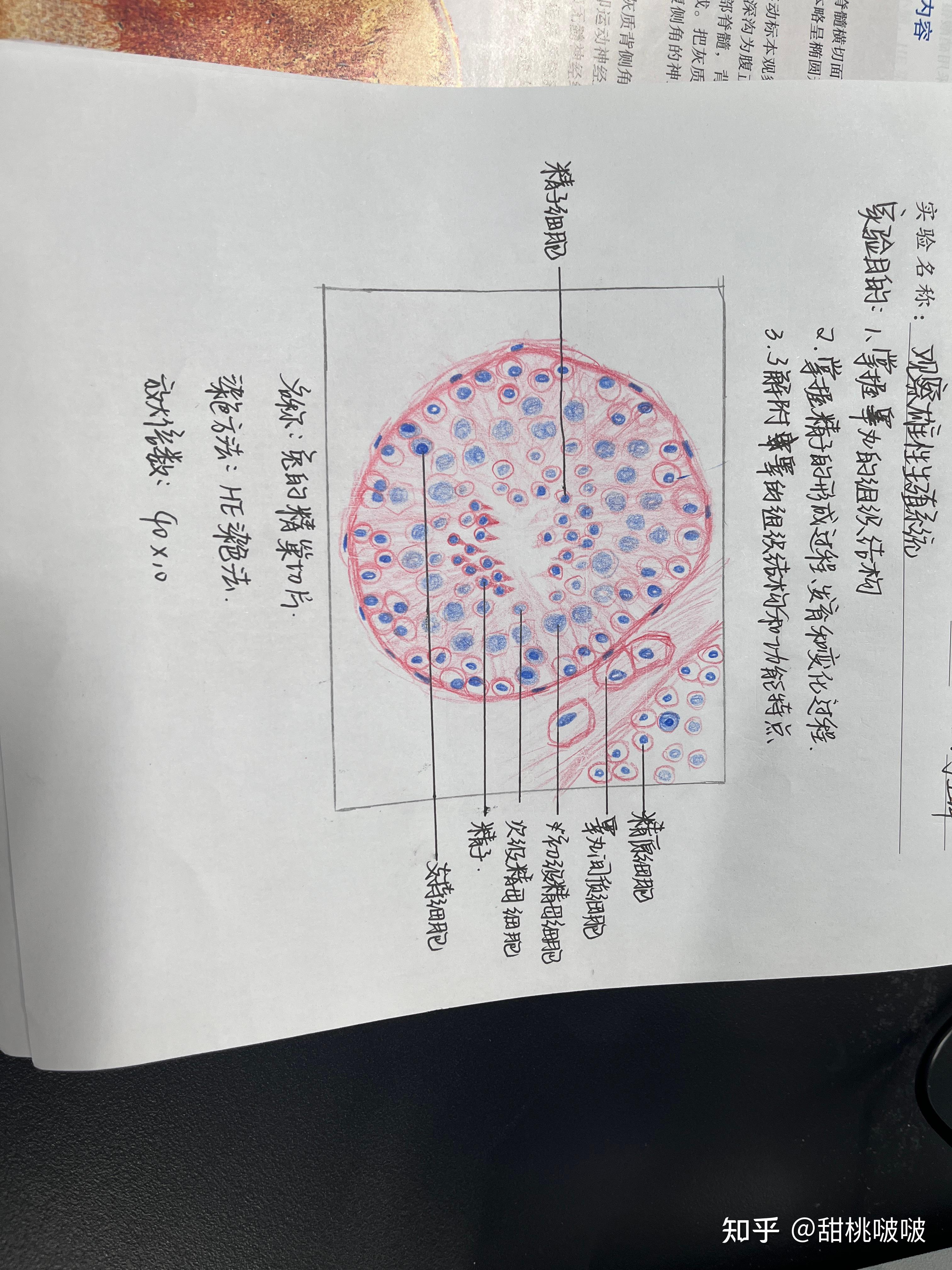 乙脑红蓝铅笔手绘图图片