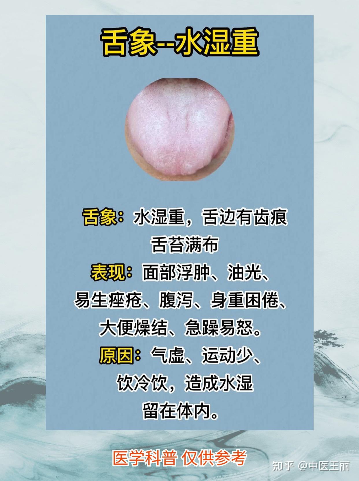 看舌象，知健康，中医教你分辨六种舌象，对比一下你有没有 - 知乎