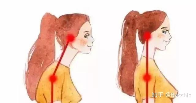 如何拉伸肩胛骨肌肉 v2-a59fd4e1b9cf13ac923f3f481c2b9215_r.jpg