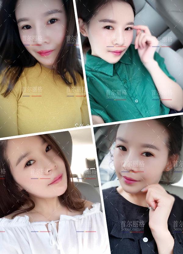 凸嘴怎么修视频 v2-a5e4cf96ca5d6cae8d20dccb03875295_r.jpg