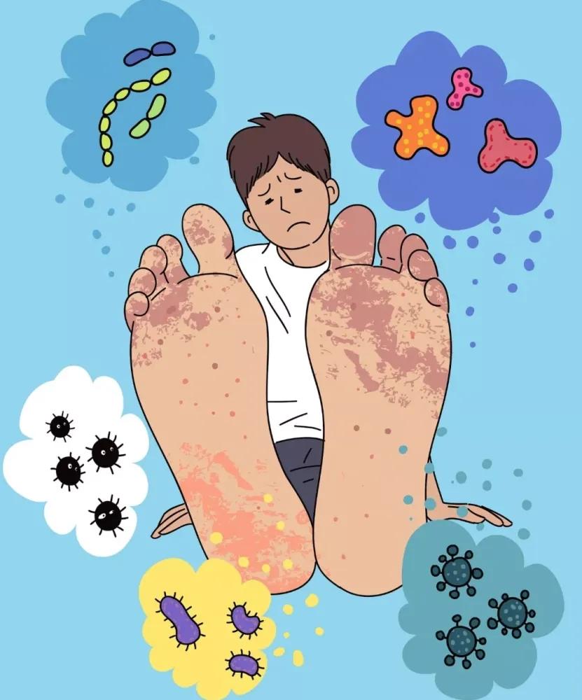 为什么会有这么多人得脚气?有什么办法解决?