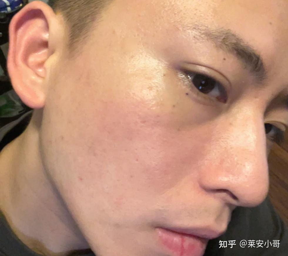 男士护肤品_男士水乳选择指南_油皮控油水乳推荐